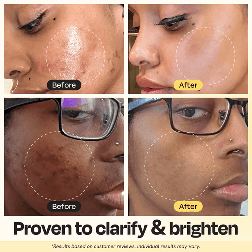 GlowClear Vitamin C Clay Mask ✨ – Brighten & Smooth Skin